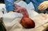 Perbandingan Nilai APGAR Bayi Pada Kelahiran Presentasi Bokong Secara Pervaginam dan Perabdominal di RSUD Kebumen Tahun 2007